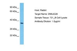 DNAJC28 Rabbit anti-Human, Polyclonal, Novus Biologicals 0.1 mL | Buy Online | Novus Biologicals | Fisher Scientific